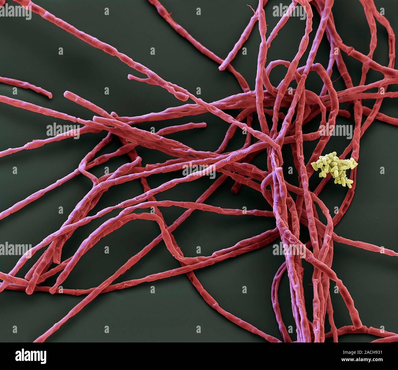 Anthrax Bacteria Coloured Scanning Electron Micrograph Sem Of Bacillus Anthracis Bacteria 4650