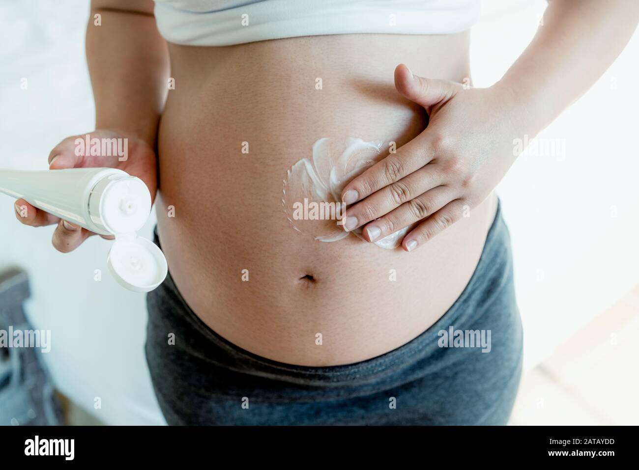 Happy Pregnant Woman Apply Skincare Cream Lotion On Pregnant Belly To Prevent Stretch Mark 