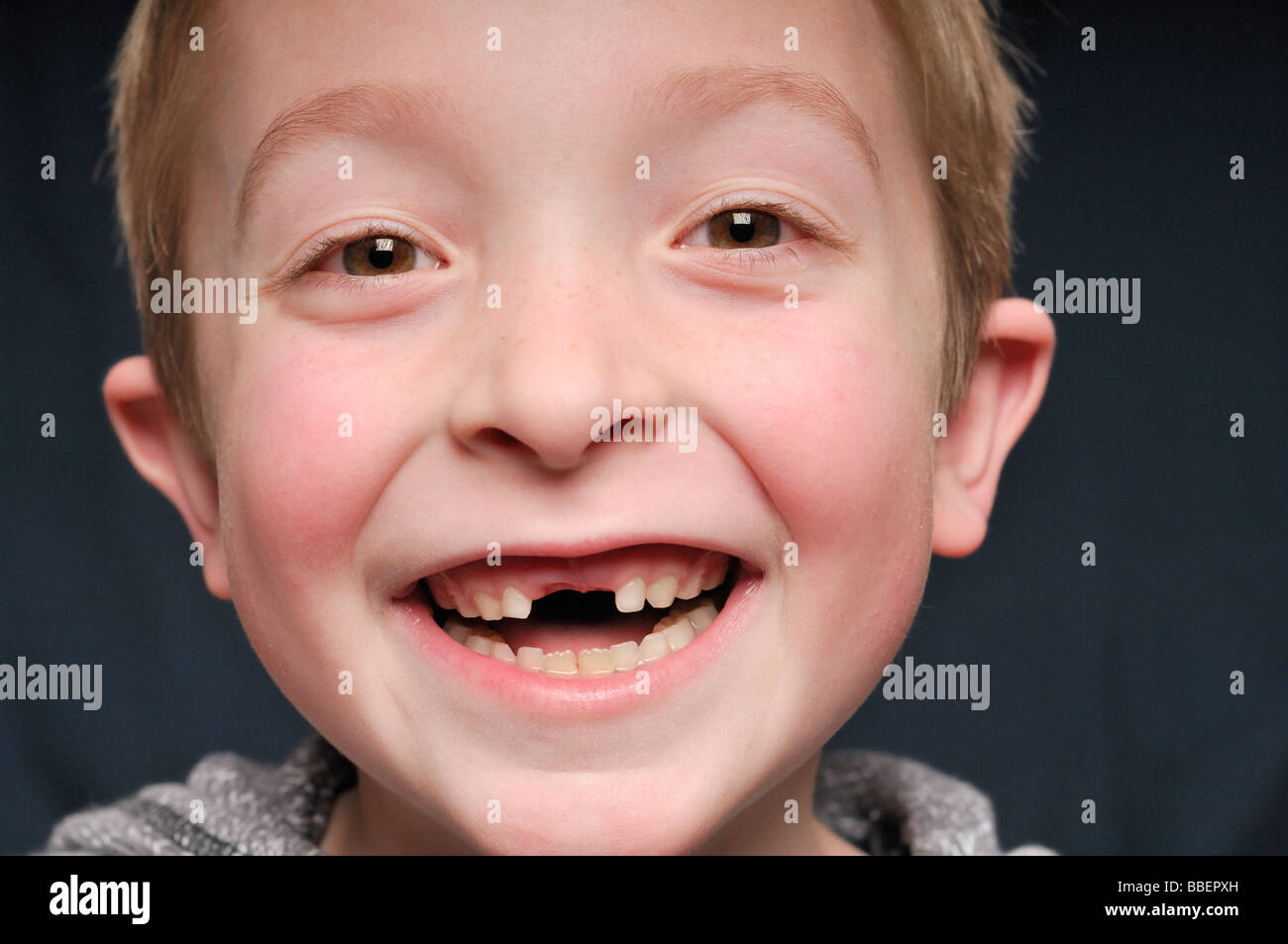 Portrait Of A Little Boy Missing Two Front Teeth Stock Photo Alamy